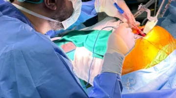 «نجاح أول عملية جراحية للشرايين باستخدام تقنية التدخل القليل»