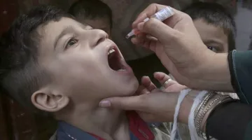زيادة حالات الإصابة بشلل الأطفال في باكستان إلى 17 حالة هذا العام