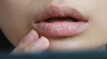 5 أسباب تسبب الشعور بالمرارة في الفم