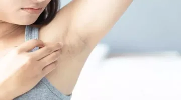 5 علامات في الإبط تشير إلى مرض خطير – احذر منها!