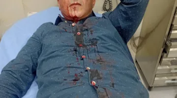 التعرض للزميل الحباشنة أمام منزله في عمان