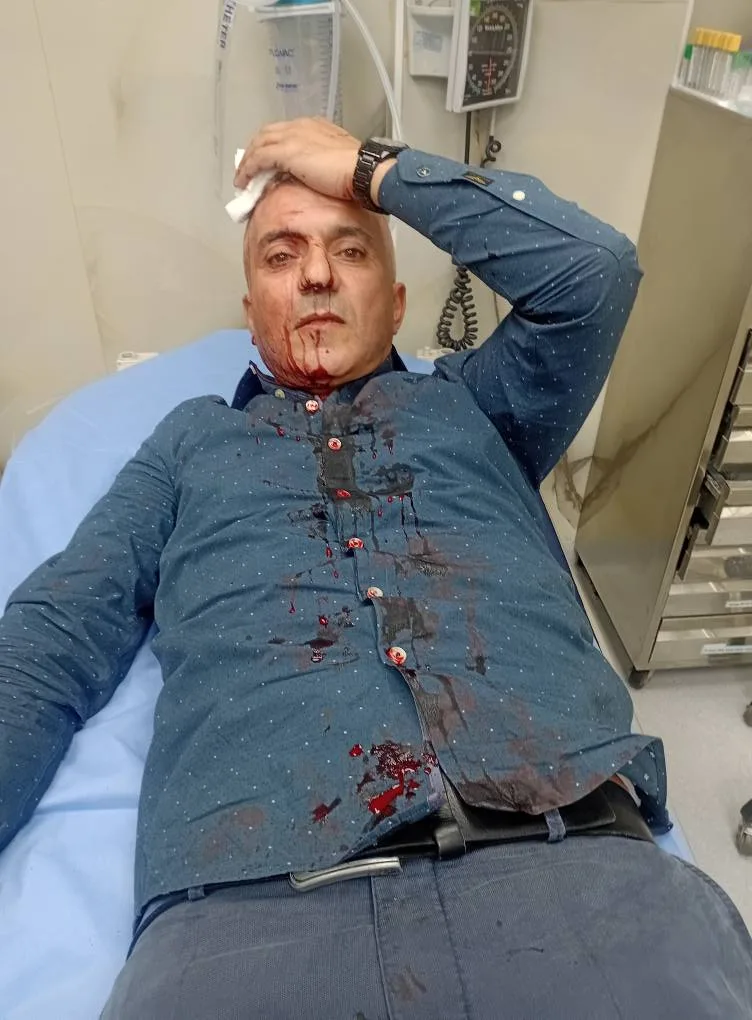 التعرض للزميل الحباشنة أمام منزله في عمان التعرض للزميل الحباشنة أمام منزله في عمان