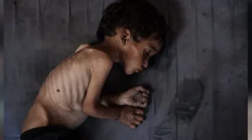غزة: تسجيل 6 حالات وفاة بسبب المجاعة وسوء التغذية في الساعات الـ 24 الماضية