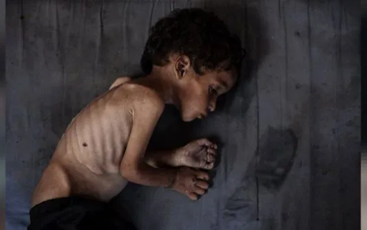 غزة: تسجيل 6 حالات وفاة بسبب المجاعة وسوء التغذية في الساعات الـ 24 الماضية غزة: تسجيل 6 حالات وفاة بسبب المجاعة وسوء التغذية في الساعات الـ 24 الماضية