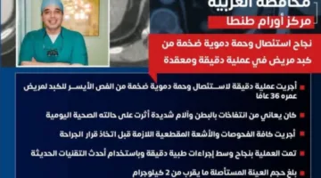جراحة غير شائعة في طنطا: إزالة ورم دموي كبير من كبد مريض بدون مضاعفات