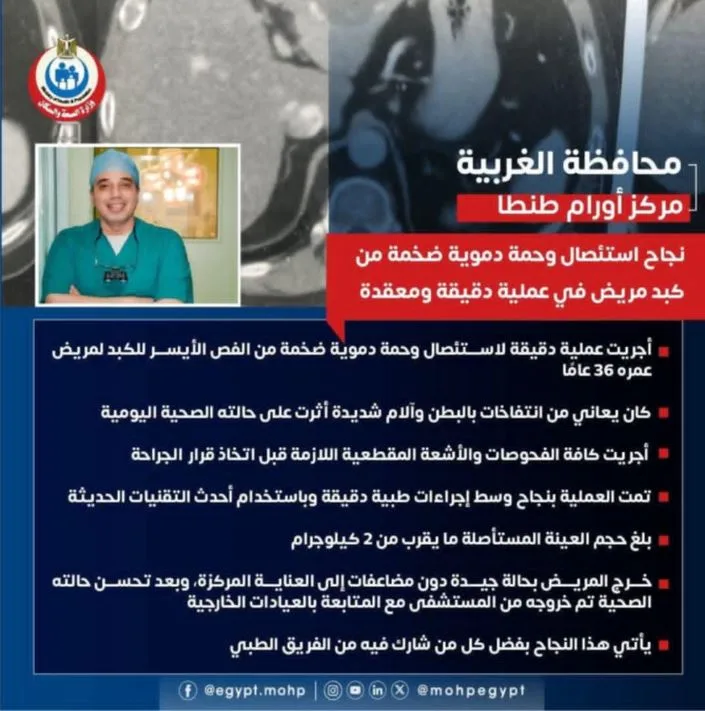 جراحة غير شائعة في طنطا: إزالة ورم دموي كبير من كبد مريض بدون مضاعفات جراحة غير شائعة في طنطا: إزالة ورم دموي كبير من كبد مريض بدون مضاعفات
