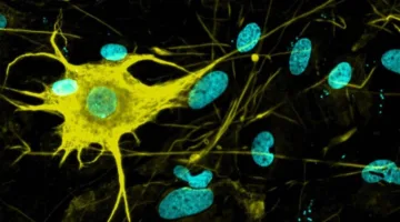 Cultivating Brain Cells in the Laboratory for Treating Alzheimer’s and Parkinson’s Diseases
