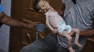 أوجاع غزة: أطفال يتألمون من الجوع ويهيمون بالموت بين ذراعي ذويهم، وعالم يشاهد بقلق وعجز.