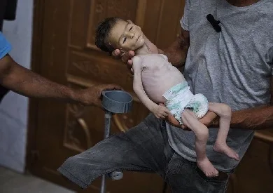 أوجاع غزة: أطفال يتألمون من الجوع ويهيمون بالموت بين ذراعي ذويهم، وعالم يشاهد بقلق وعجز. أوجاع غزة: أطفال يتألمون من الجوع ويهيمون بالموت بين ذراعي ذويهم، وعالم يشاهد بقلق وعجز.