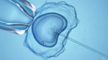 صدمة علمية.. ولادة 8 أطفال أصحاء يحملون مواد وراثية من ثلاثة آباء!