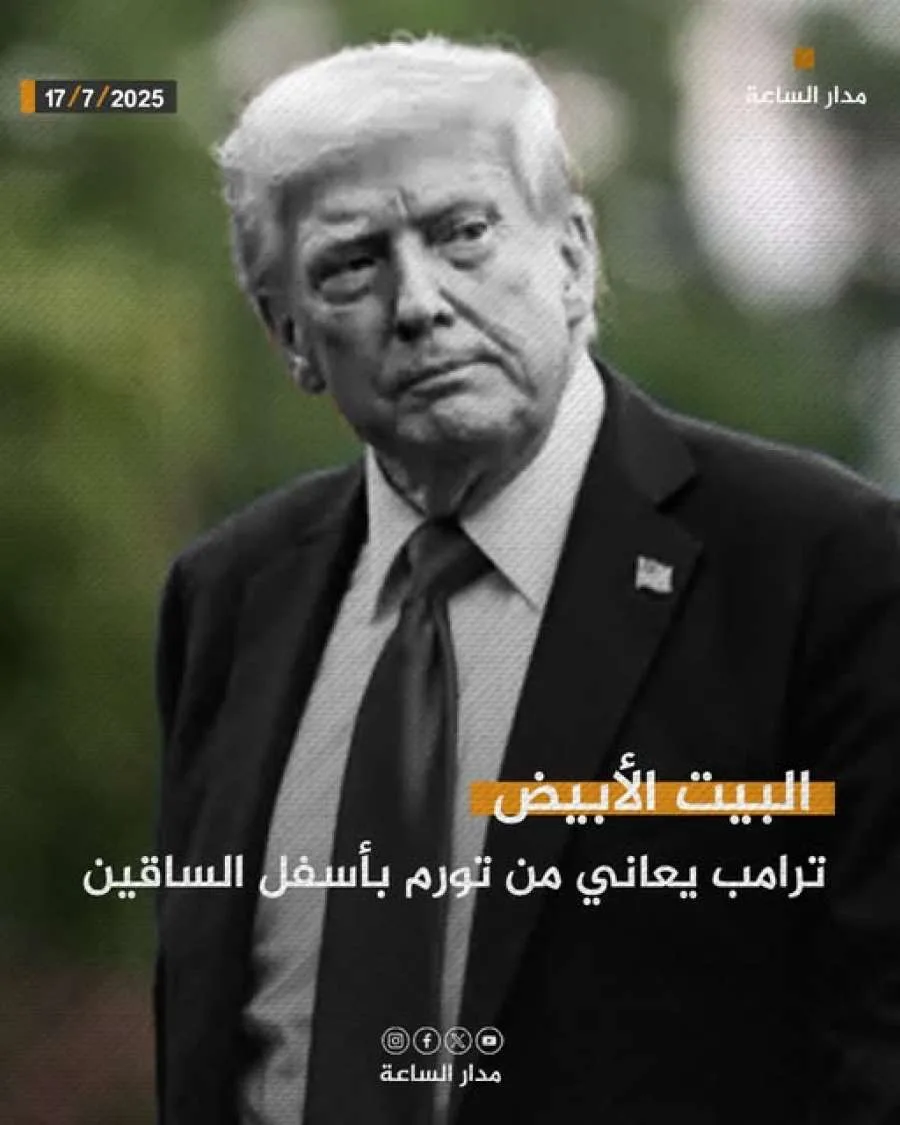 ترامب يعاني من انتفاخ في ساقيه.. كيف ترتبط المصافحة بأسبرين؟