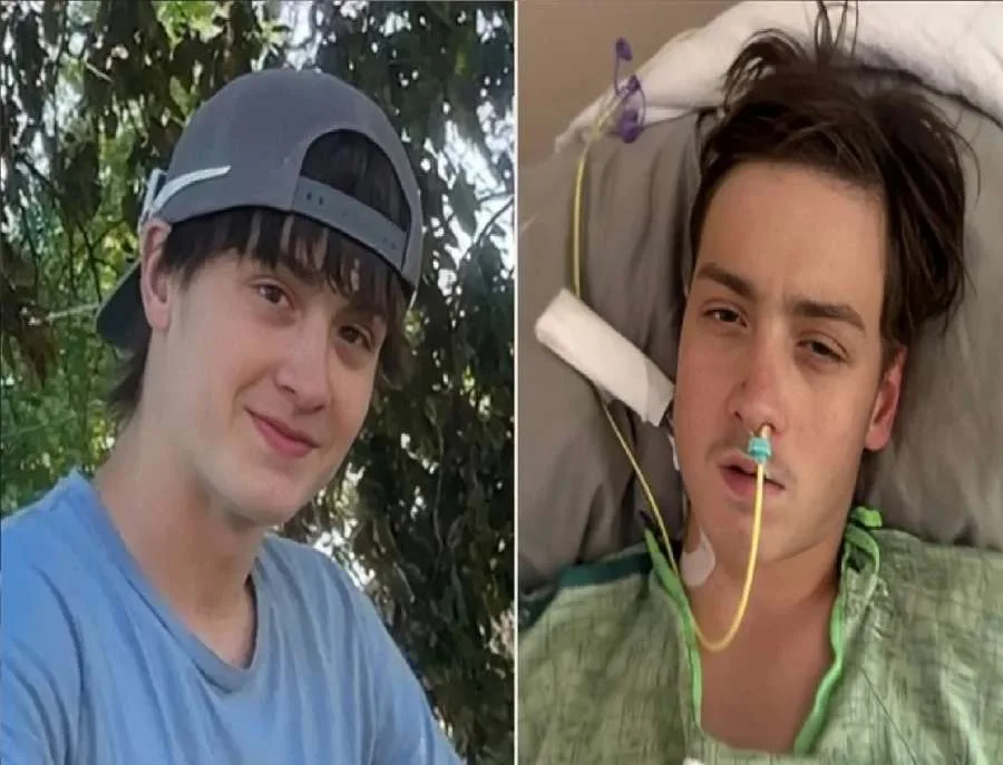 لدغة عنكبوت تهدد حياة مراهق.. صراع للبقاء ونقلة معجزة نحو النجاة لدغة عنكبوت تهدد حياة مراهق.. صراع للبقاء ونقلة معجزة نحو النجاة