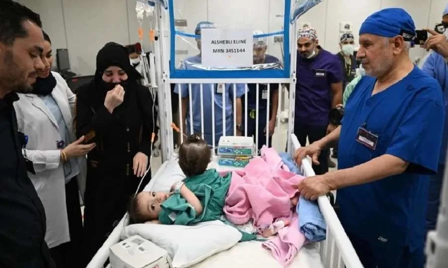 نجاح عملية فصل التوأم السوري سيلين وإيلين في الرياض بعد إجراء معقد نجاح عملية فصل التوأم السوري سيلين وإيلين في الرياض بعد إجراء معقد