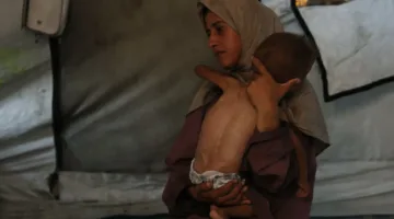 أطباء بلا حدود: 25% من الأطفال في غزة يعانون من نقص التغذية