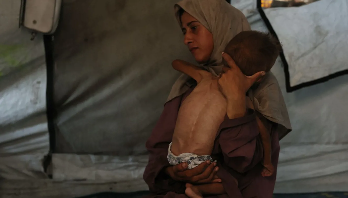 أطباء بلا حدود: 25% من الأطفال في غزة يعانون من نقص التغذية أطباء بلا حدود: 25% من الأطفال في غزة يعانون من نقص التغذية