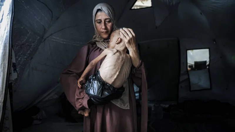أكثر من 100 منظمة إنسانية تحذر من تدهور أوضاع سكان غزة بسبب انتشار المجاعة الجماعية.