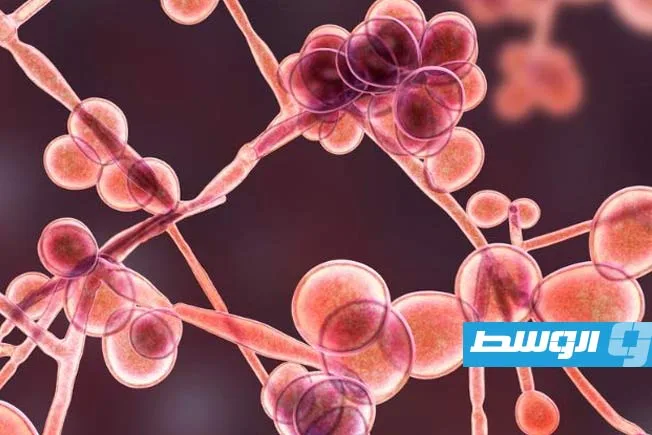 «ألبيومين الدم»: الجانب المخفي في تحول عدوى الخميرة إلى تهديد قاتل.