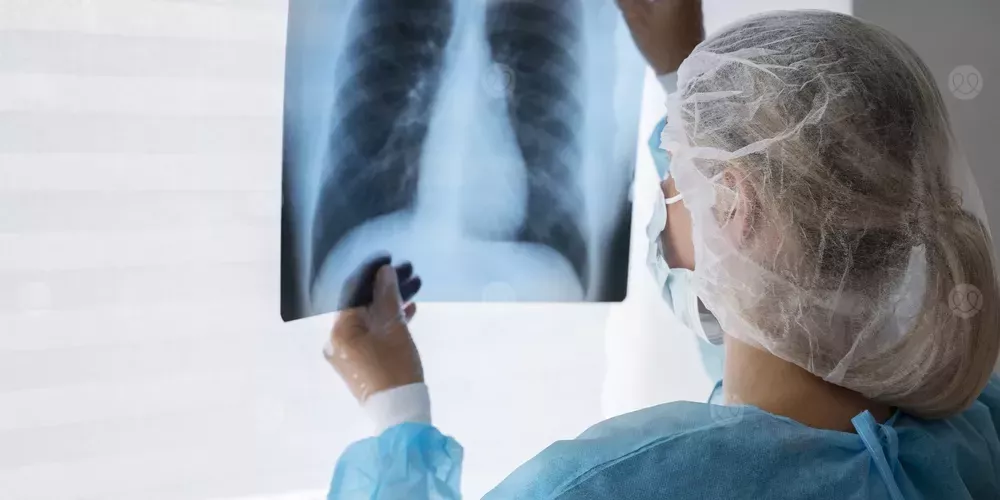 اكتشاف أسلوب مبتكر لعلاج سرطان الرئة