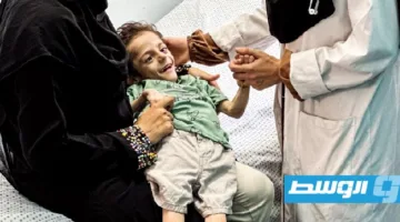 الأمم المتحدة: 18.7 ألف طفل فلسطيني في المستشفيات نتيجة سوء التغذية في قطاع غزة