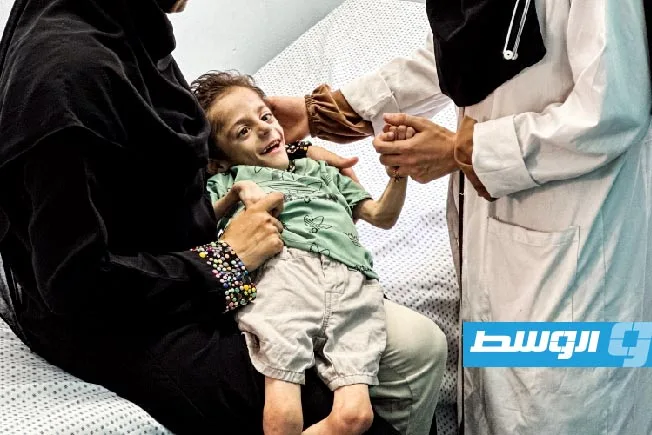 الأمم المتحدة: 18.7 ألف طفل فلسطيني في المستشفيات نتيجة سوء التغذية في قطاع غزة