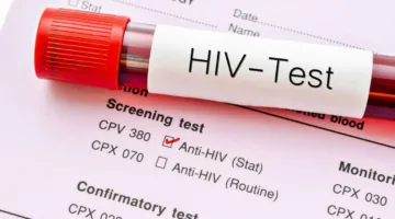 الأمم المتحدة: دول ذات دخل منخفض تسعى لسد فجوة تمويل الإيدز، لكن جهود الوقاية تشهد تراجعاً