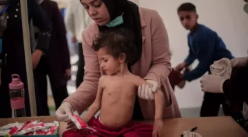 الأونروا: واحد من كل عشرة أطفال في غزة يعاني من سوء التغذية بعد الفحص.