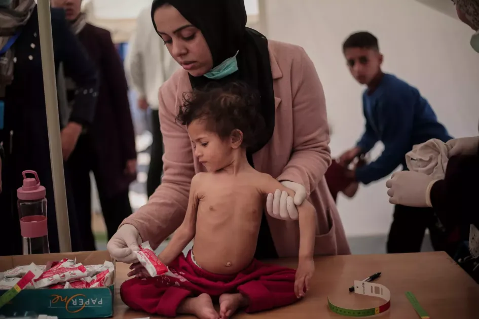 الأونروا: واحد من كل عشرة أطفال في غزة يعاني من سوء التغذية بعد الفحص.