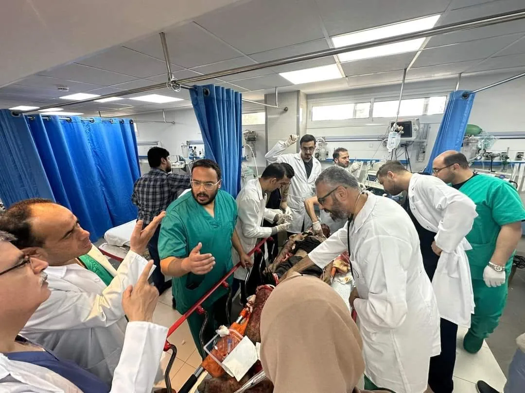 الجوع الإسرائيلي.. جانب آخر من معاناة الأطباء في غزة