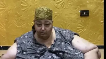 الحاجة فاطمة تشارك تجربتها مع السمنة الزائدة: “كنت كالحصان”