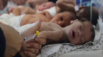 المجاعة جعلتهم كـ «هياكل عظمية مغطاة بالجلد».. أطفال غزة عاجزون حتى عن البكاء