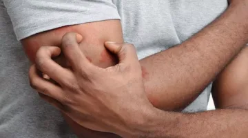 انتبه: الحكة بعد الاستحمام قد تدل على مشاكل صحية خطيرة.