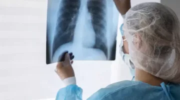 انهيار الرئة قد يؤدي إلى الوفاة.. تعرف على العلامات وأساليب العلاج