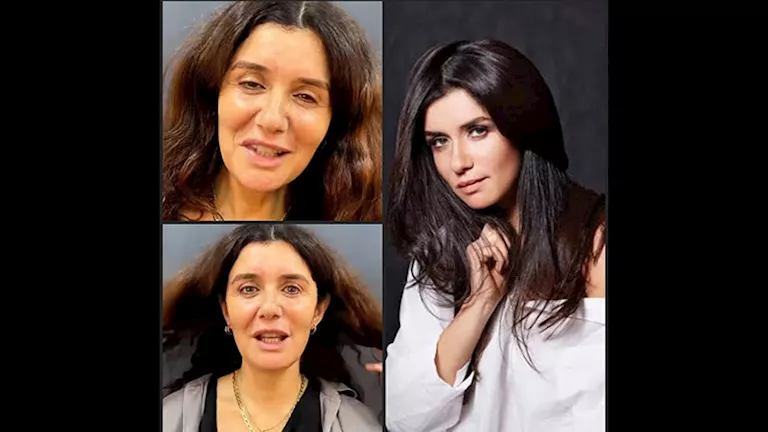 بالفيديو والصور.. غادة عادل قبل وبعد إجراء عملية تجميل “رفع الوجه” بالفيديو والصور.. غادة عادل قبل وبعد إجراء عملية تجميل “رفع الوجه”