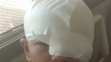 تحقيقات شاملة بشأن اتهام طفل بتشويه وجه زميله في الجيزة