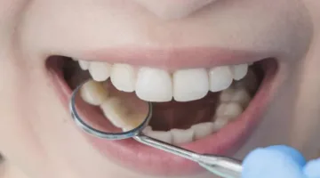 تدهور صحة الأسنان مرتبط بالأمراض المزمنة