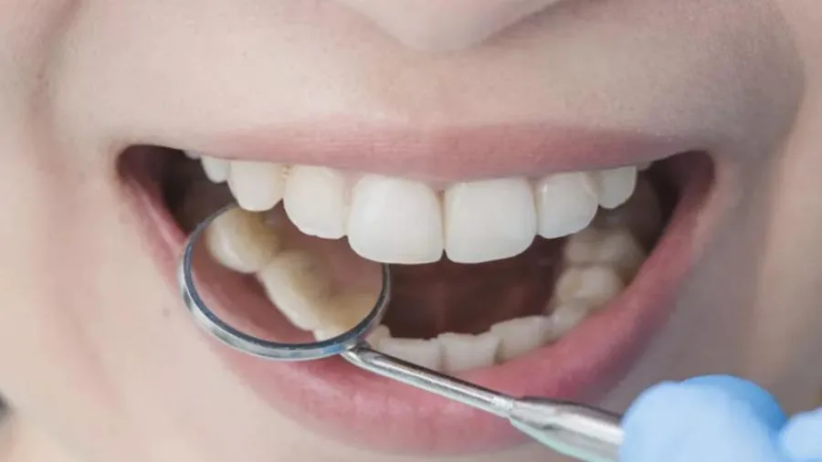 تدهور صحة الأسنان مرتبط بالأمراض المزمنة تدهور صحة الأسنان مرتبط بالأمراض المزمنة