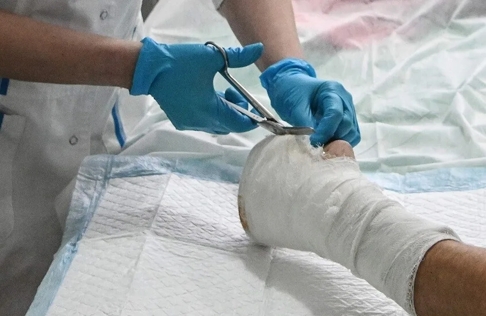 تطوير طلاء مضاد للبكتيريا لتحسين أداء الغرسات القابلة للتحلل الحيوي