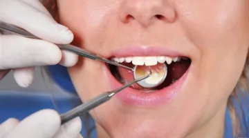 حتى مع التنظيف اليومي: احذر من هذه الأخطاء الشائعة التي تضر بأسنانك