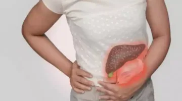 حقيقة أم وهم: هل يمكن معالجة الكبد الدهني باستخدام ماء الليمون؟