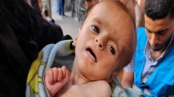 زيادة عدد شهداء المجاعة في غزة إلى 122 شهيدًا