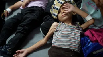 زيادة عدد ضحايا سوء التغذية في قطاع غزة ليصل إلى 69 طفلًا