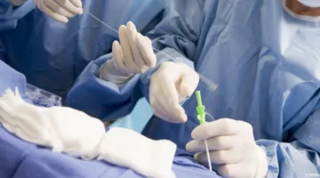 عملية جراحية تنقذ حياة رجل في الأربعين بعد تعرضه لتلف كامل في مفصل المرفق بسبب سقوط.