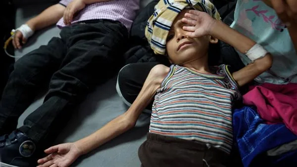 غزة: 122 شخصًا فقدوا حياتهم بسبب المجاعة وسوء التغذية، بينهم 83 طفلًا غزة: 122 شخصًا فقدوا حياتهم بسبب المجاعة وسوء التغذية، بينهم 83 طفلًا
