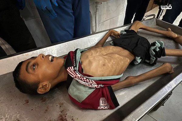 كاتبة إسرائيلية تعبر عن استنكارها: نحن نشاهد برامج الطهي بينما يعاني أطفال غزة من الجوع. كاتبة إسرائيلية تعبر عن استنكارها: نحن نشاهد برامج الطهي بينما يعاني أطفال غزة من الجوع.
