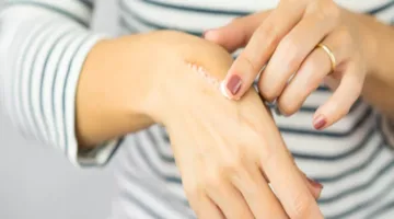لماذا نبقى نشعر بالألم حتى بعد اختفاء السبب؟