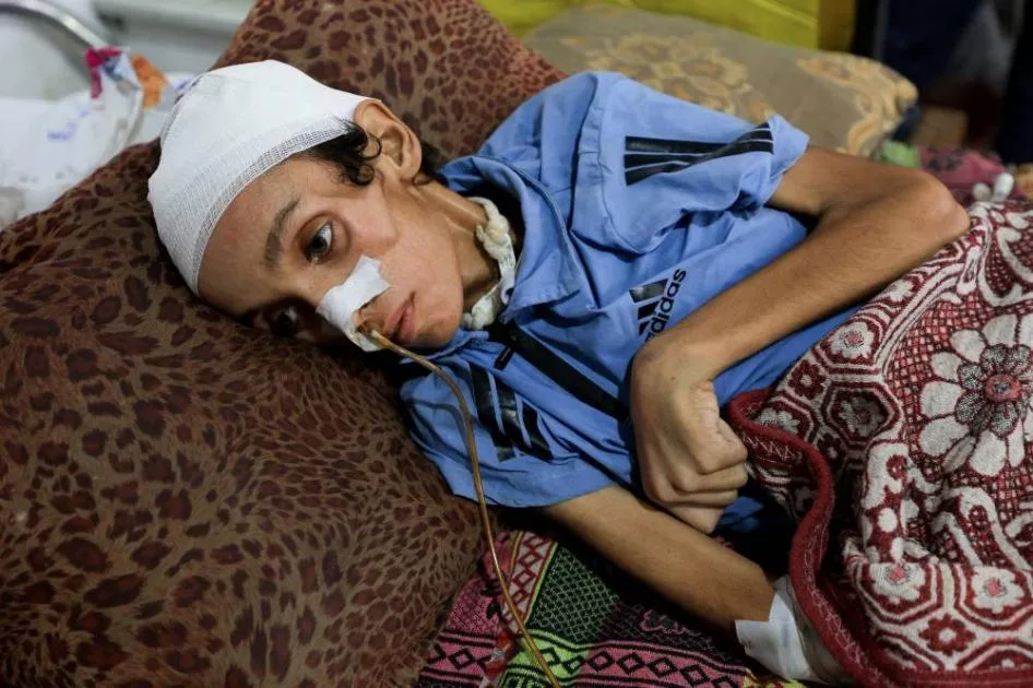 مقتل 21 طفلًا جوعًا في غزة خلال 72 ساعة مقتل 21 طفلًا جوعًا في غزة خلال 72 ساعة