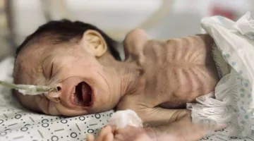 موت طفلة جراء الحصار الإسرائيلي في غزة