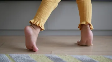 هل تعكس أسلوب مشي الطفل احتمال تعرضه للتوحد؟ دراسة توضح الأمر