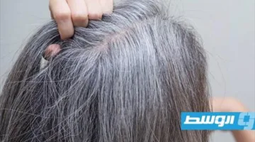 وصفة طبيعية لإزالة الشيب من الشعر