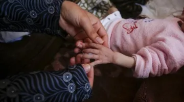 وفاة طفلة تبلغ من العمر سنة ونصف نتيجة نقص التغذية في قطاع غزة